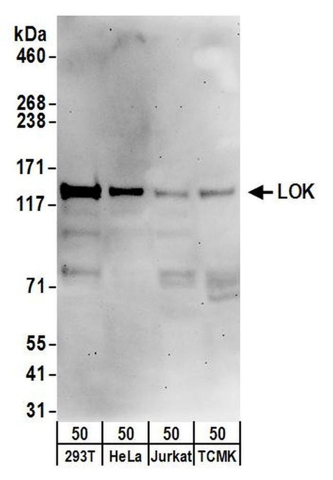 LOK Antibody in Western Blot (WB)