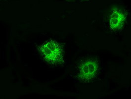 LOX Antibody in Immunocytochemistry (ICC/IF)