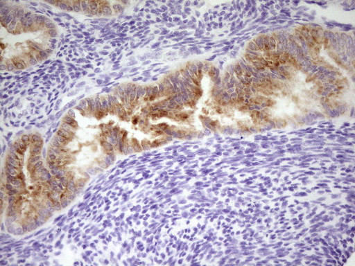 LPIN3 Antibody in Immunohistochemistry (Paraffin) (IHC (P))