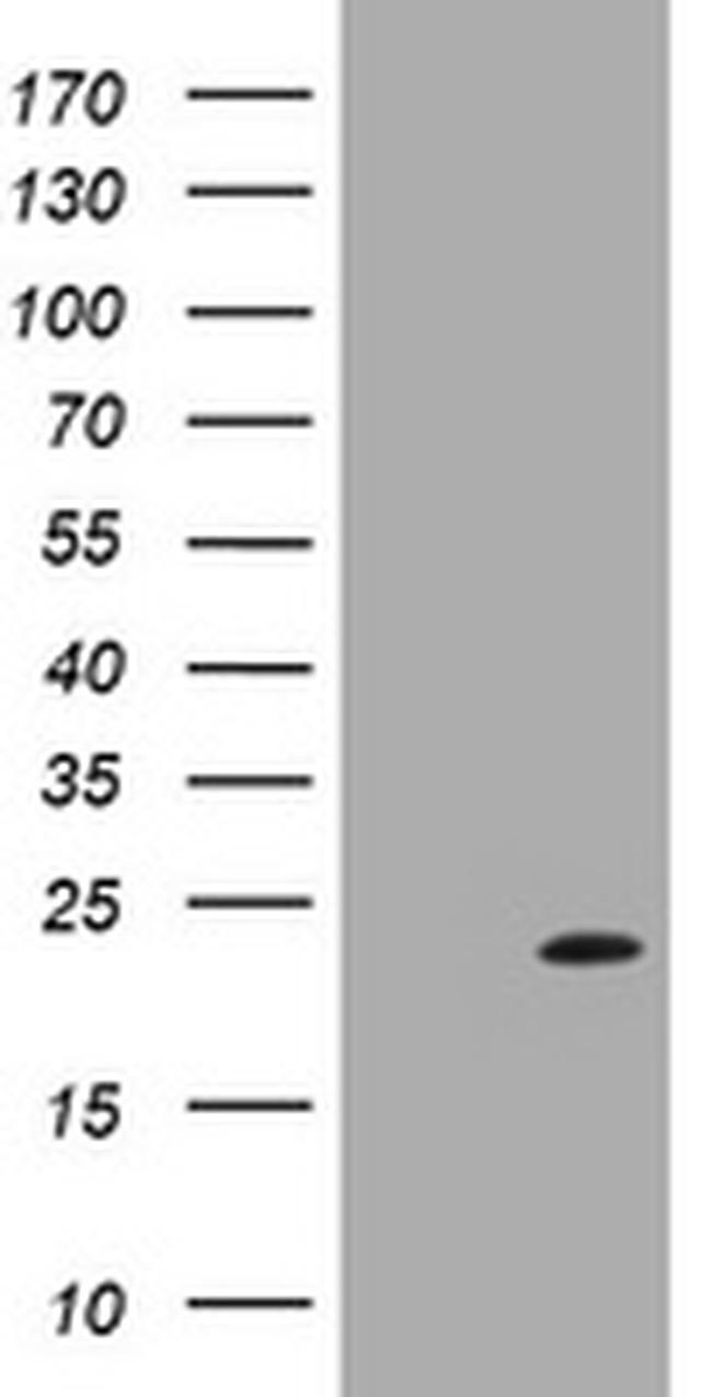 LZIC Antibody in Western Blot (WB)