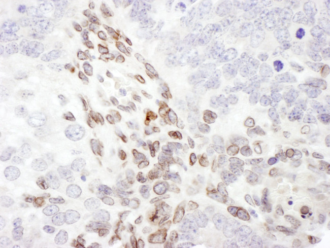 Lamin-A Antibody in Immunohistochemistry (IHC)