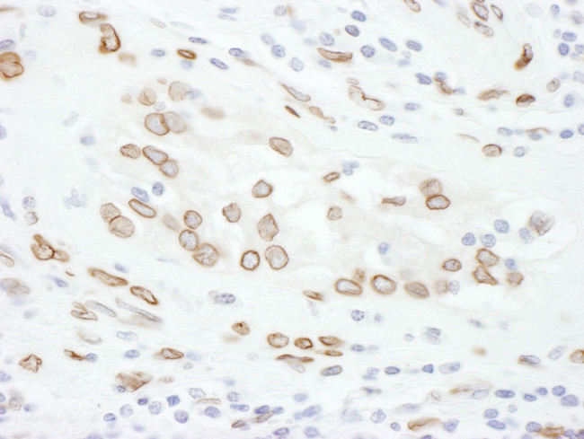 Lamin-A Antibody in Immunohistochemistry (IHC)