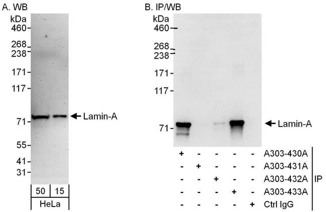 Lamin-A Antibody in Western Blot (WB)