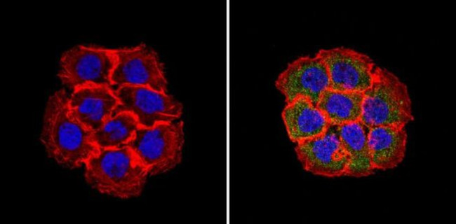 RhoA/RhoB/RhoC Antibody in Immunocytochemistry (ICC/IF)