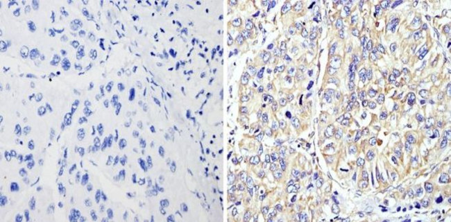 RhoA/RhoB/RhoC Antibody in Immunohistochemistry (Paraffin) (IHC (P))