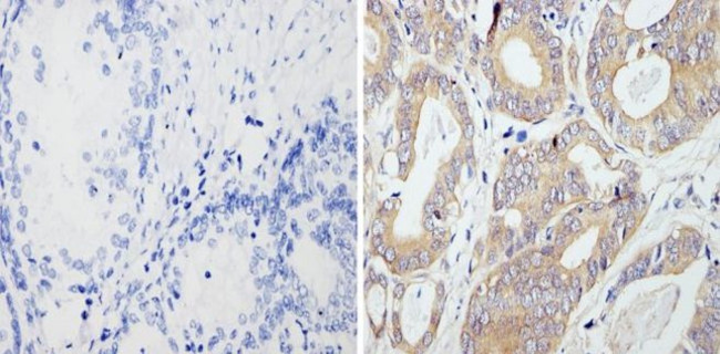 RhoA/RhoB/RhoC Antibody in Immunohistochemistry (Paraffin) (IHC (P))