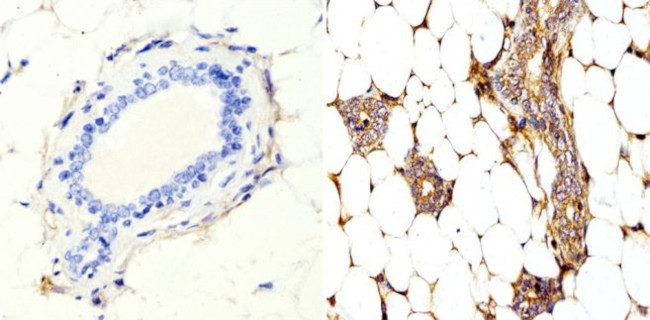 RhoA/RhoB/RhoC Antibody in Immunohistochemistry (Paraffin) (IHC (P))