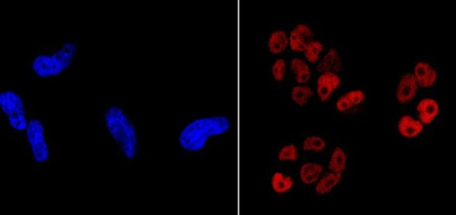 Nanog Antibody in Immunocytochemistry (ICC/IF)