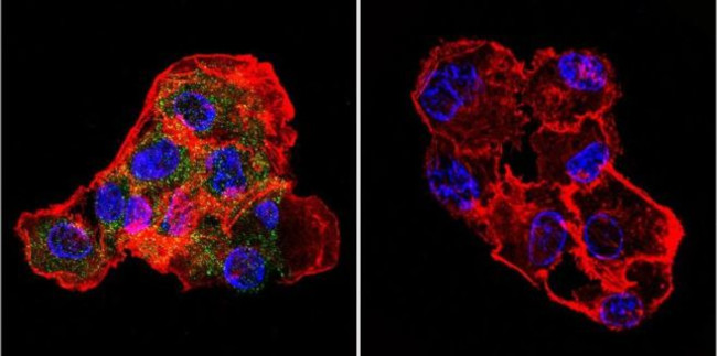 CETP Antibody in Immunocytochemistry (ICC/IF)