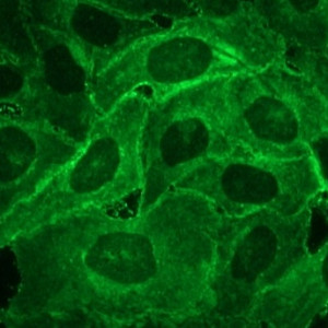 E-selectin Antibody in Immunocytochemistry (ICC/IF)