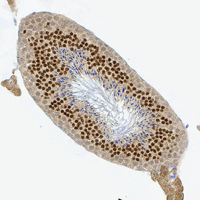 Nkx3.1 Antibody in Immunohistochemistry (Paraffin) (IHC (P))