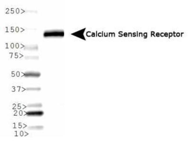 Calcium Sensing Receptor Antibody in Western Blot (WB)