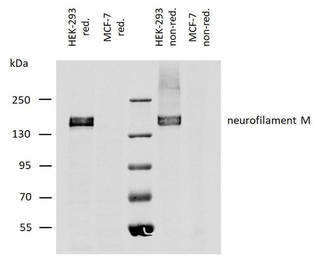 NEFM Antibody in Western Blot (WB)