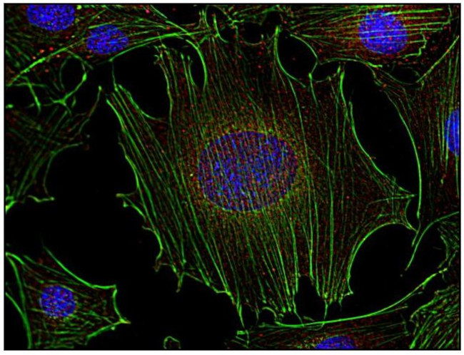 Fyn Antibody in Immunocytochemistry (ICC/IF)