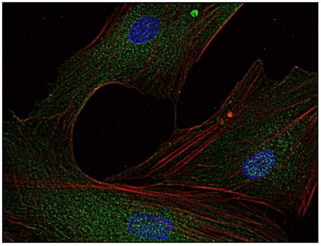 Fyn Antibody in Immunocytochemistry (ICC/IF)