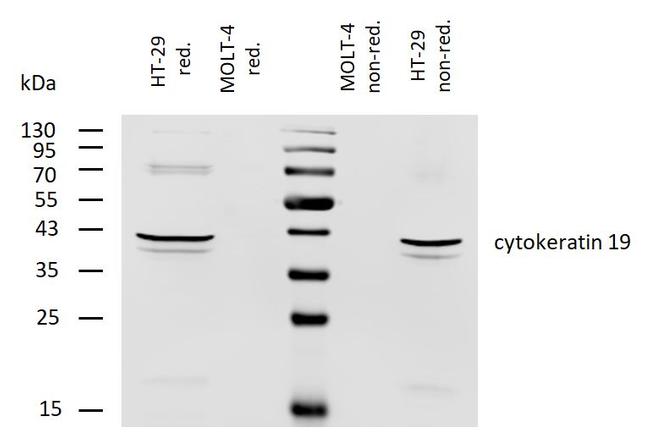 Cytokeratin 19 Antibody in Western Blot (WB)