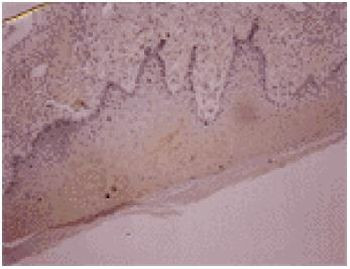 Osteocalcin Antibody in Immunohistochemistry (Paraffin) (IHC (P))