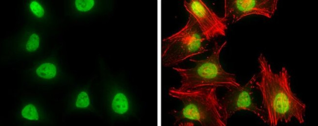 RbAp46/RbAp48 Antibody in Immunocytochemistry (ICC/IF)