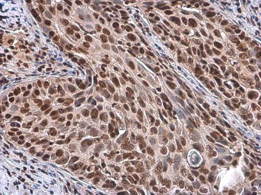 RbAp46/RbAp48 Antibody in Immunohistochemistry (Paraffin) (IHC (P))