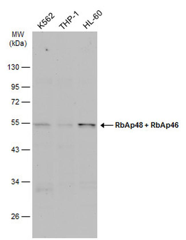 RbAp46/RbAp48 Antibody in Western Blot (WB)