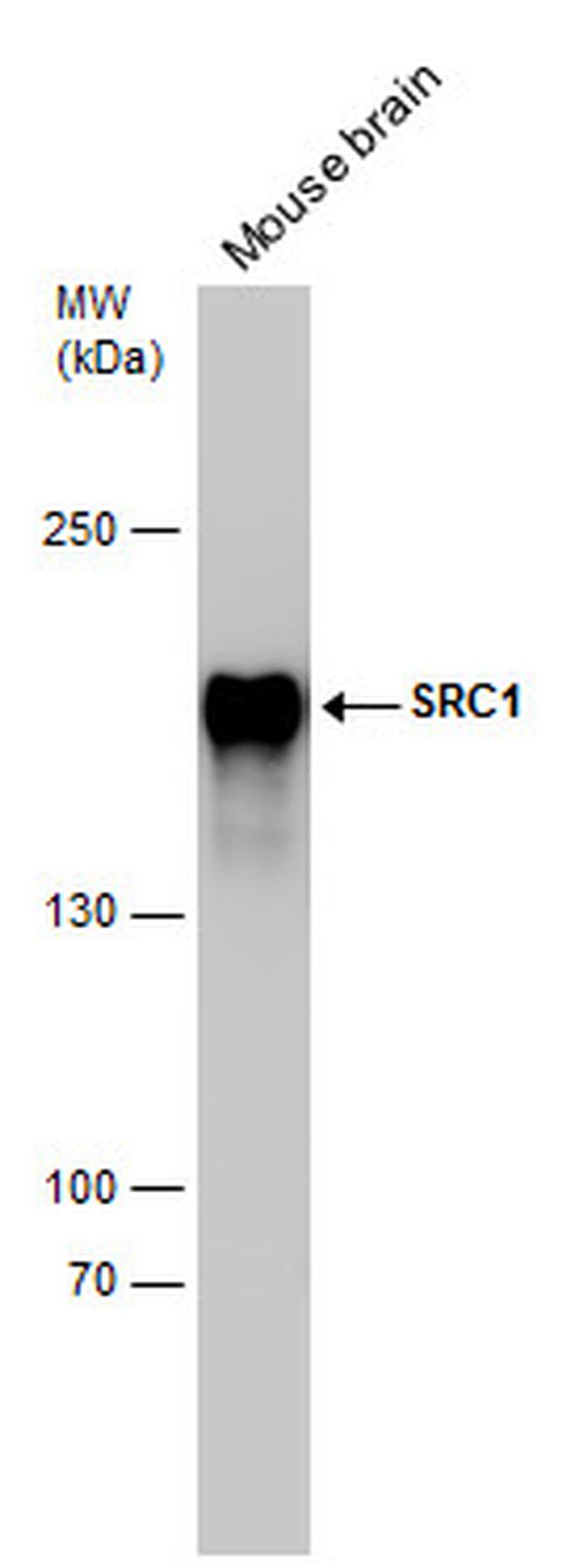 SRC1 Antibody in Western Blot (WB)