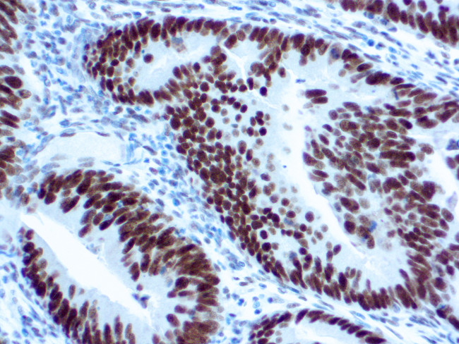 MLH1 Antibody in Immunohistochemistry (Paraffin) (IHC (P))