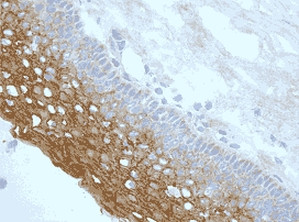 NLRP3 Antibody in Immunohistochemistry (Frozen) (IHC (F))