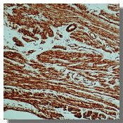 Alpha-Smooth Muscle Actin Antibody in Immunohistochemistry (Paraffin) (IHC (P))