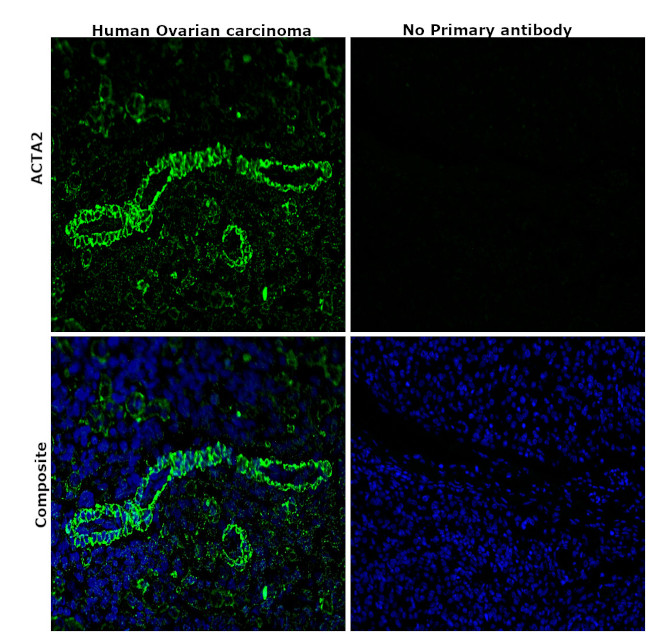 Alpha-Smooth Muscle Actin Antibody in Immunohistochemistry (Paraffin) (IHC (P))