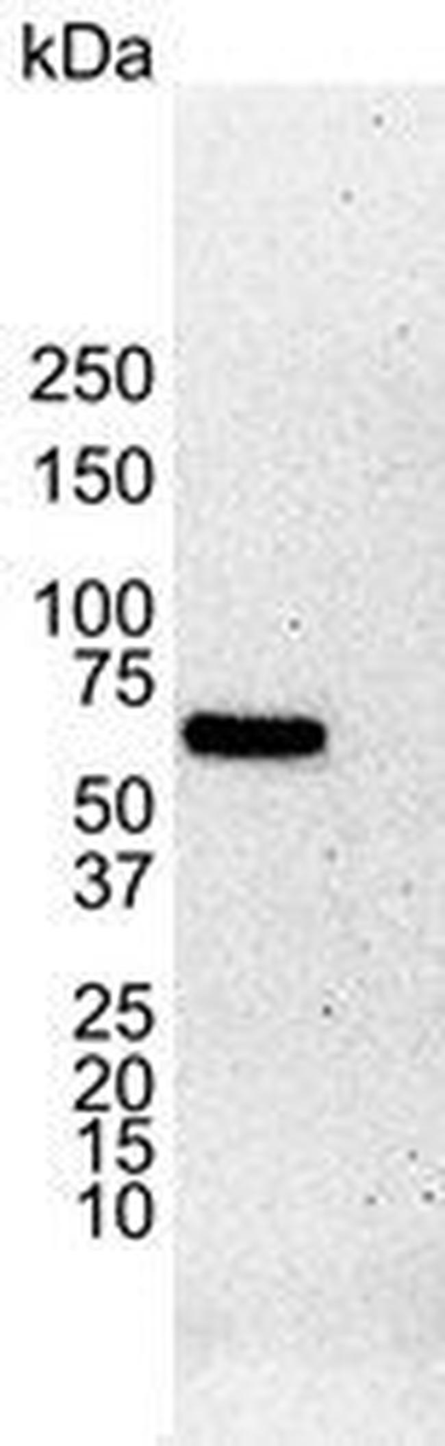 Estrogen Receptor alpha Antibody in Western Blot (WB)