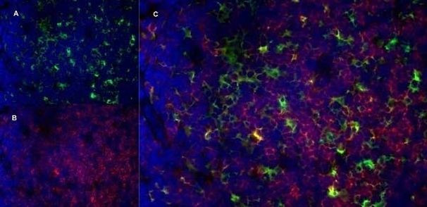 CD13 Antibody in Immunohistochemistry (Frozen) (IHC (F))