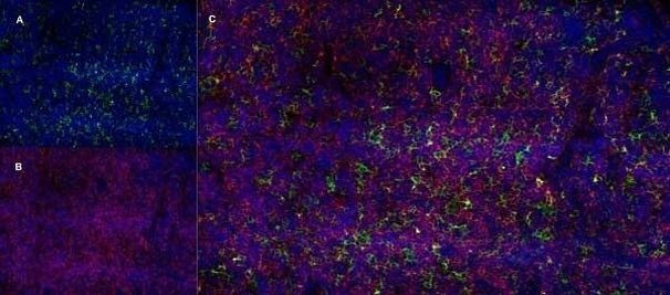 CD13 Antibody in Immunohistochemistry (Frozen) (IHC (F))