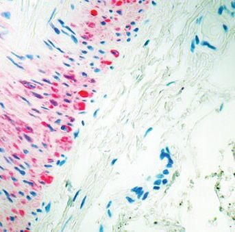 HPV Type 16 L1 Antibody in Immunohistochemistry (Paraffin) (IHC (P))