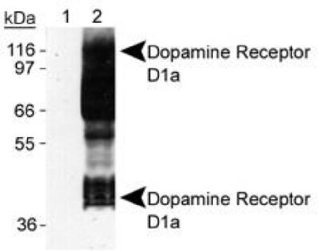 DRD1 Antibody in Western Blot (WB)