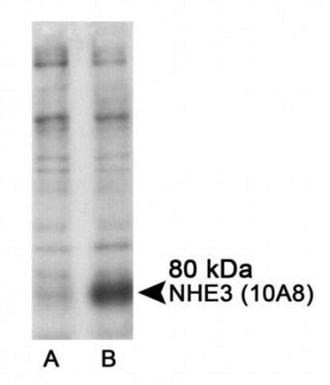 Phospho-NHE3 (Ser605) Antibody in Western Blot (WB)