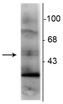 RXRG Antibody in Western Blot (WB)