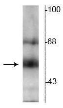 THRB Antibody in Western Blot (WB)