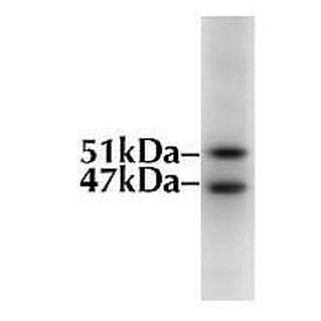 GSK3B Antibody in Western Blot (WB)