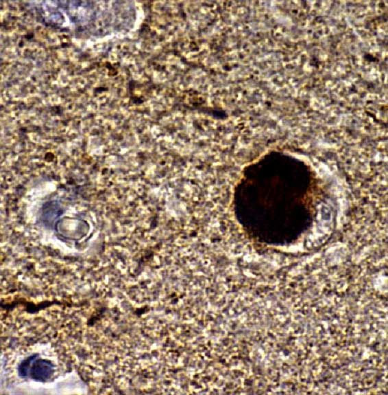 alpha Synuclein Antibody in Immunohistochemistry (IHC)