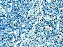 Cytomegalovirus IE + Early Antigen Antibody in Immunohistochemistry (IHC)