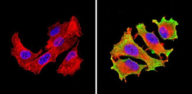 eIF1 Antibody in Immunocytochemistry (ICC/IF)