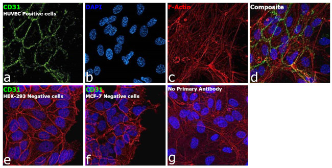 CD31 Antibody in Immunocytochemistry (ICC/IF)