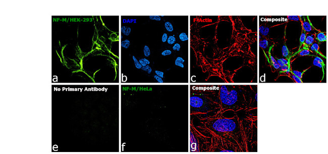 NEFM Antibody in Immunocytochemistry (ICC/IF)