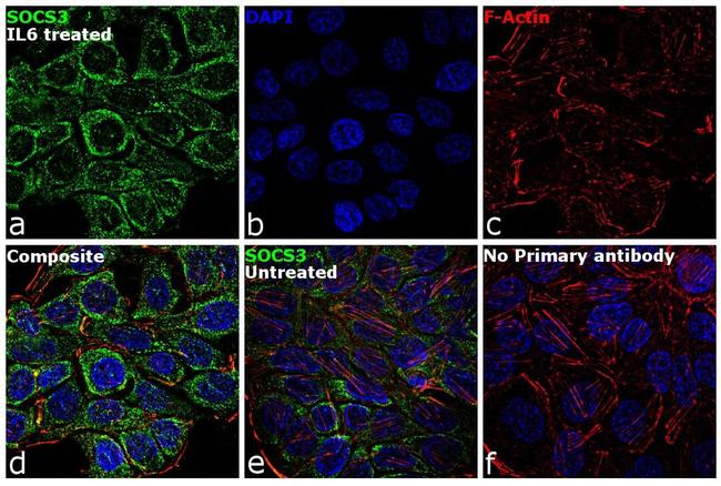 SOCS3 Antibody