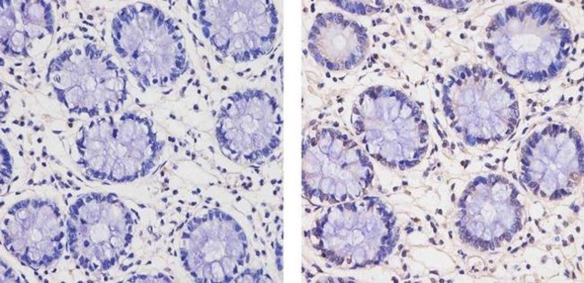 THRB Antibody in Immunohistochemistry (Paraffin) (IHC (P))