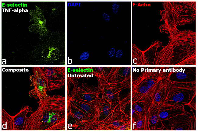 E-selectin Antibody in Immunocytochemistry (ICC/IF)