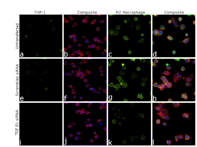 TGF beta-1 Antibody in Immunocytochemistry (ICC/IF)