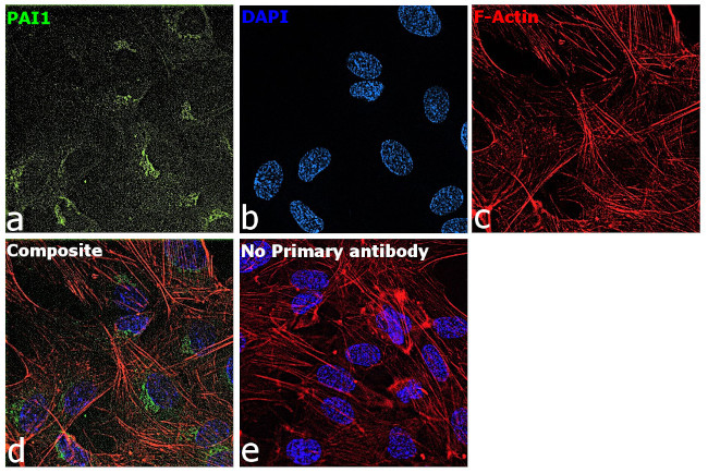 PAI1 Antibody in Immunocytochemistry (ICC/IF)