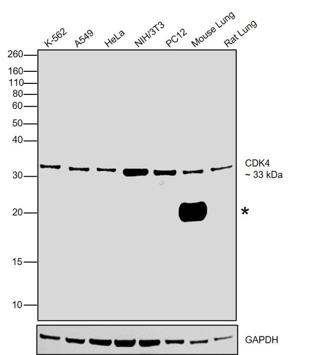 CDK4 Antibody in Western Blot (WB)