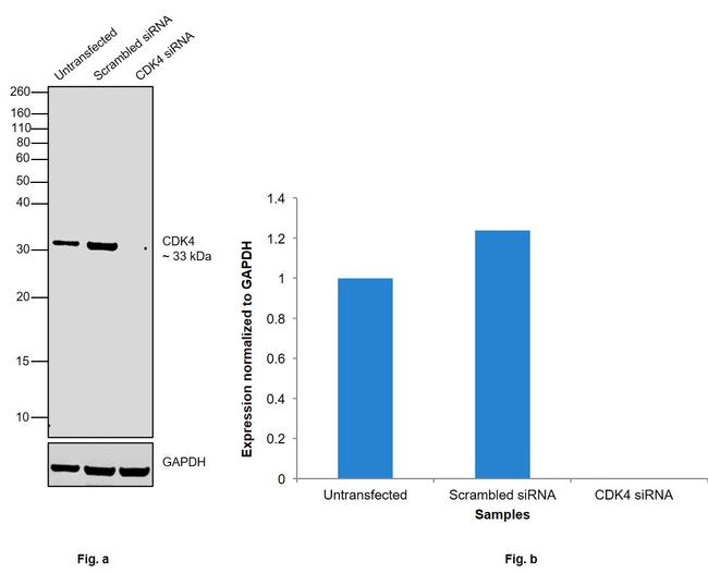 CDK4 Antibody in Western Blot (WB)